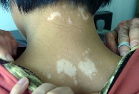 结婚七年丈夫突然提离婚，原因竟是因为它！